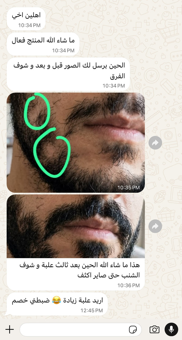 محادثة زبون 2